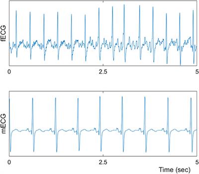 Alterations in Maternal–Fetal Heart Rate Coupling Strength and Directions in Abnormal Fetuses